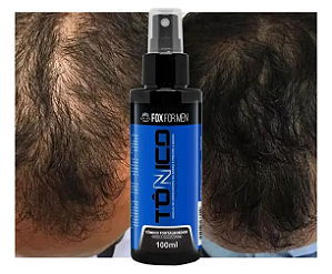 Tônico Capilar Fox For Men 100ml (Cabelo e Barba)