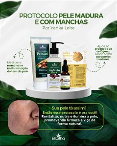 Protocolo Yanka Leite: Para madura e com manchas + Brinde (Dolomita em pó 200g e a Pomada de rosa mosqueta)