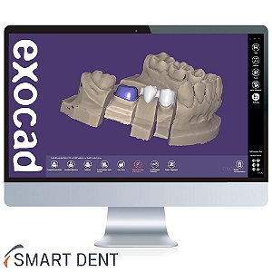 DentalCAD - Software CAD da exocad