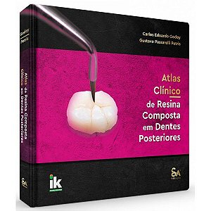 Atlas Clínico de Resina Composta em Dentes Posteriores - 1ª Edição 2022