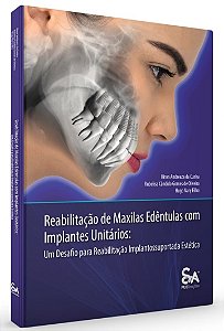 Reabilitação de Maxilas Edêntulas com Implantes Unitários: Um desafio para Reabilitação Implantossuportada Estética - 1ª Ed/23