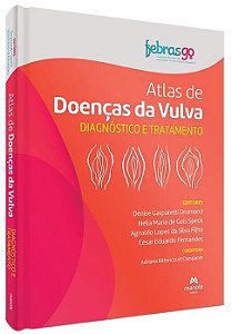 Atlas de Doenças da Vulva - 1º Edição 2023