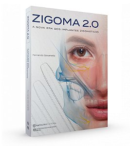 ZIGOMA 2.0 - A Nova era dos Implantes Zigomáticos - 1ª Edição 2023