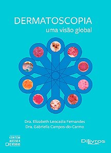 Dermatoscopia Uma Visão Global - 1ª Edição 2023