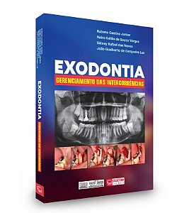 EXODONTIA - GERENCIAMENTO DAS INTERCORRÊNCIAS - 1ª Edição 2024