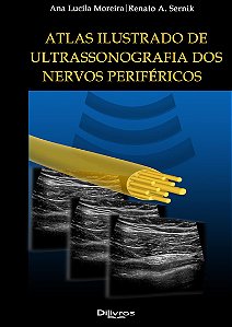 Atlas Ilustrado Ultrasonografia dos Nervos Perifericos - 1ª Edição 2024