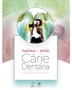 Cárie Dentária: Fisiopatologia e Tratamento - 4ª Edição 2026