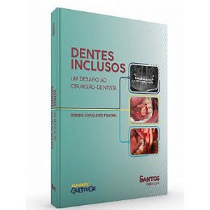 Dentes Inclusos - Um desafio ao Cirurgião-dentista - 1ª Edição 2021