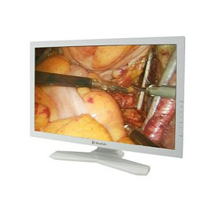 Monitor Cirúrgico 24” MS247S 1920 x 1200 Full HD - Reshin