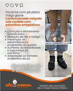 Calçado Sob Medida para Pé Plano Valgo Grave