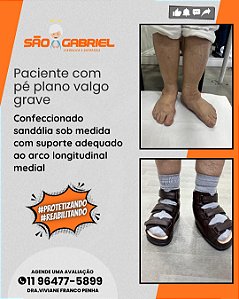 Sandália Ortopedica sob medida