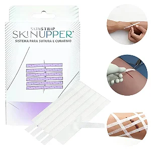 Sistema para Sutura e Curativo Ponto Falso 01-unid Skinupper