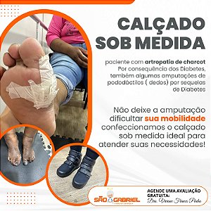 Calçado Sob Medida para Artropatia de Charcot