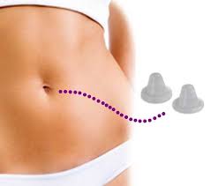 Órtese p/úmbigo anatômica