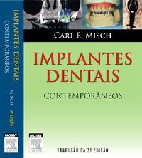 IMPLANTES DENTAIS CONTEMPORÂNEOS - CARL MISCH