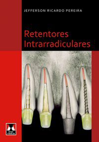 RETENTORES INTRARRADICULARES - PEREIRA, JEFFERSON RICARDO