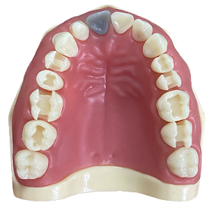 Manequim Dentística superior preparo para faceta (cod.103N)