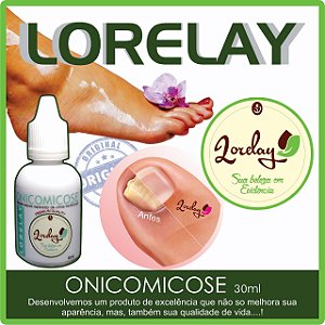 ONICOMICOSE