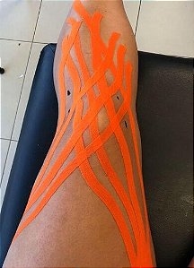 Curso Presencial: Kinesio Taping + Bandagem Rígida (02 e 03 de Dezembro de 2023 em RECIFE/PE)