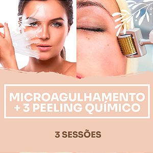 3 SESSÕES DE MICROAGULHAMENTO + 3 PEELINGS QUÍMICOS