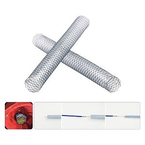 Prótese Biliar 8.5Fr Endoscópica Totalmente Revestida Stent NITI-S