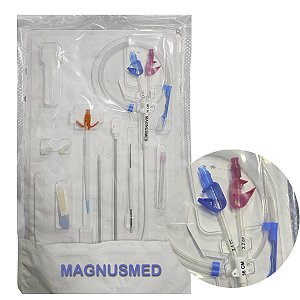 Cateter Hemodialise e Plasmaférese Duplo Lumen 14,5fr x 36cm Longa Permanência - Innova KFF