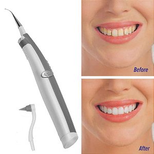 Equipamento Elétrico Sônico para Remoção de Placa/Limpeza dos Dentes/Remoção de Mancha Dentária/Cuidados de Higiene Oral