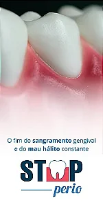 Folder Stop Perio - 50 Unidades