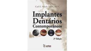 Livro Implantes Dentários Contemporâneos Autor Misch, Carl E. (2006) [usado]