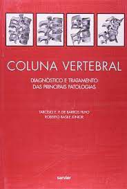 Livro Coluna Vertebral: Diagnóstico e Tratamento das Principais Patologias Autor Filho, Tarcísio E. P. de Barros (1997) [usado]