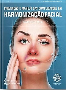 Livro Prevenção e Manejo das Complicações em Harmonização Facial Autor Souza, Alexandre de (2020) [usado]