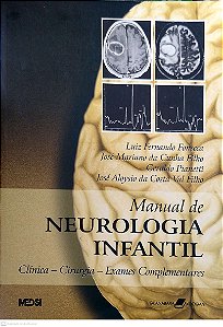 Livro Manual de Neurologia Infantil Autor Diversos Autores (2006) [usado]