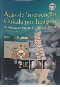 Livro Atlas de Intervenção Guiada por Imagem na Anestesia Regional e Clínica da Dor Autor Rathmell, James P. (2012) [usado]