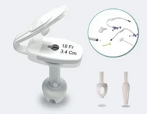 DUPLICADO - Kit para Gastrostomia Endoscópica Percutânea (KIT PEG) - BLENTA (Sonda de Início) 20FR