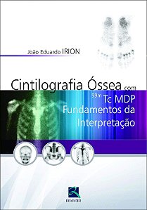 Cintilografia Óssea com 99mTc MDP - Fundamentos da Interpretação - João Eduardo Irion
