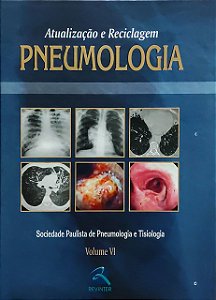 Pneumologia - Volume 6 - Mauro Gomes; Vários Autores