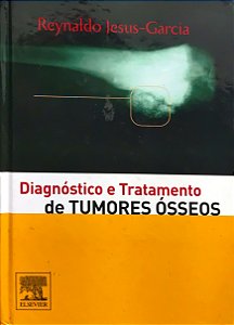 Diagnóstico e Tratamento de Tumores Ósseos - Reynaldo Jesus-Garcia