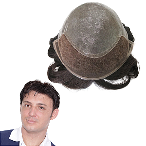 Prótese Capilar Masculina Base Micropele Fontal Em Tela Castanho Escuro 40% Grisalho 20x25 cm 130% Densidade