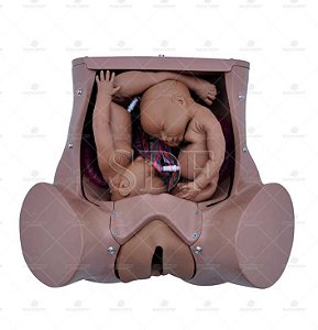 Simulador de Parto Gemelar com Placenta e Cordão Umbilical SD-4010 -Sdorf