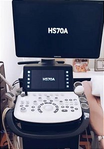 Ultrassom HS70A - 3 Gerais + 3D/4D -  SAMSUNG