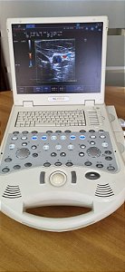 Ultrassom Portátil MyLab 25 Gold - Linear e Setorial Adulto - Esaote