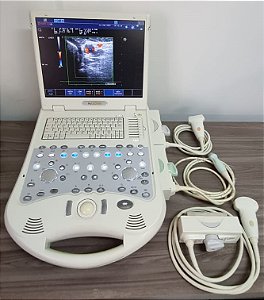Ultrassom Portátil MyLab 25 Gold - Linear, Convexo e Setorial Adulto - Esaote