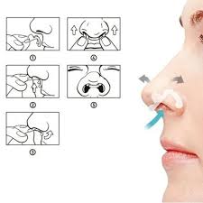 FLUX AIR - DILATADOR NASAL INTERNO - MÉDIO