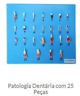 PATOLOGIA DENTÁRIA COM 15 PÇS
