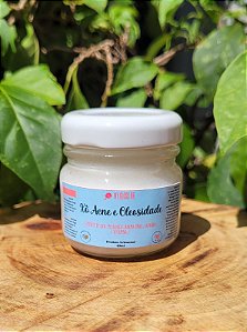 Creme Hidratante para Acne e Oleosidade - 40ml