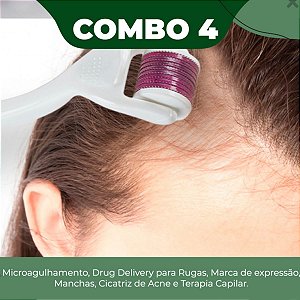 Curso  Microagulhamento Drug Delivery Face e Capilar Combo 04