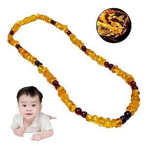 Colar De Âmbar Para Bebês Saúde Natural E Conforto Bicudos