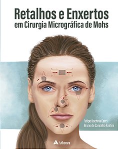 Livro Retalhos e enxertos em cirurgia micrográfica de Mohs