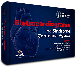 Livro Eletrocardiograma na síndrome coronária aguda