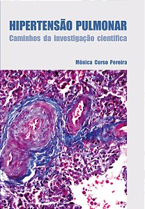 Livro Hipertensão Pulmonar - Caminhos Da Investigação Científic...